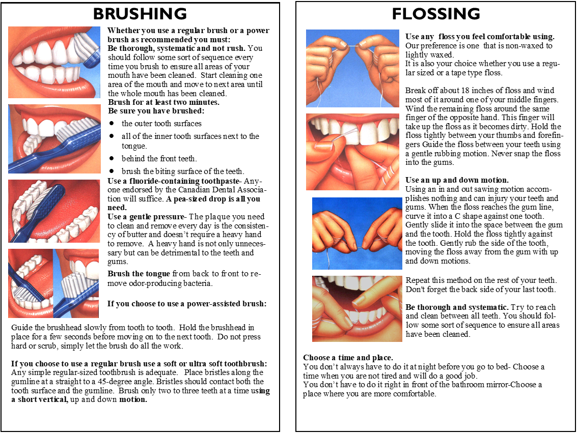 brushing flossing - Crown & Bridge Home Care Instructions - Guy Dentistry