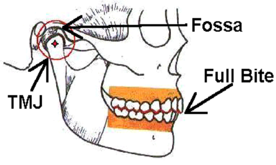 full bite - OCCLUSAL EQUILIBRATION - Guy Dentistry