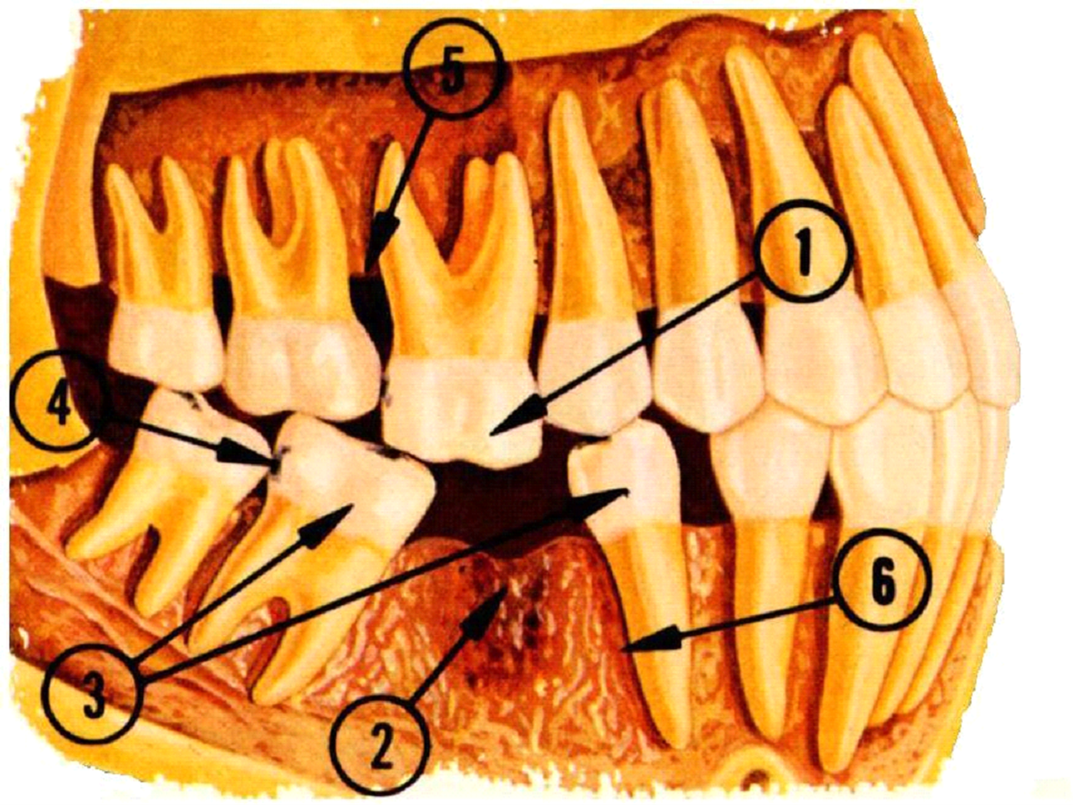 missing2 - Dental Bridges - Guy Dentistry